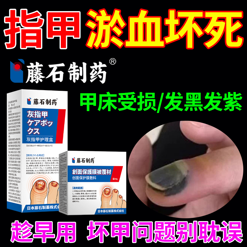 脚趾甲被砸指甲被夹压受损甲下淤血发黑发紫甲床受伤专用生长液XP