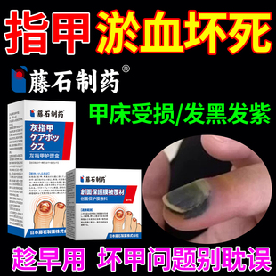 脚趾甲被砸指甲被夹压受损甲下淤血发黑发紫甲床受伤专用生长液XP