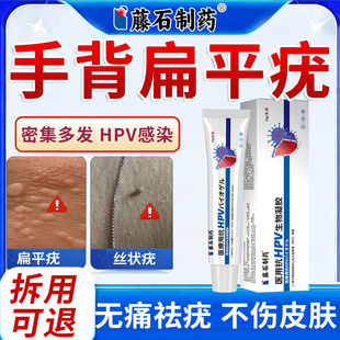 藤石制药手背扁平疣抗HPV生物凝胶去扁平疣丝状疣特专用效医用RB