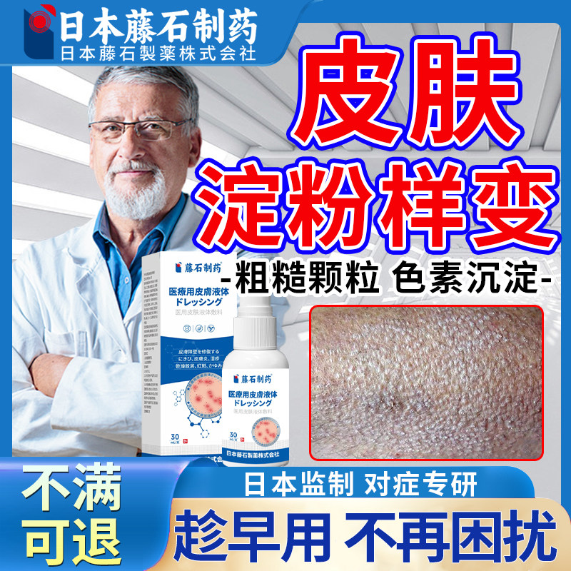 皮肤淀粉样变专特用顽固后背大小腿黑色素皮肤粗糙可搭止痒药膏XP,保健用品,皮肤消毒护理（消）,淘宝优惠券,粉丝福利购,淘宝优惠卷