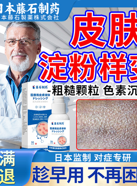 皮肤淀粉样变专特用顽固后背大小腿黑色素皮肤粗糙可搭止痒药膏XP