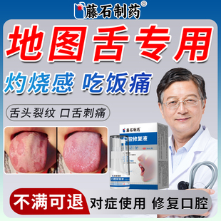 舌头裂纹有齿痕舌苔白厚舌炎地图舌医用调理灼口综合症药房同款XP