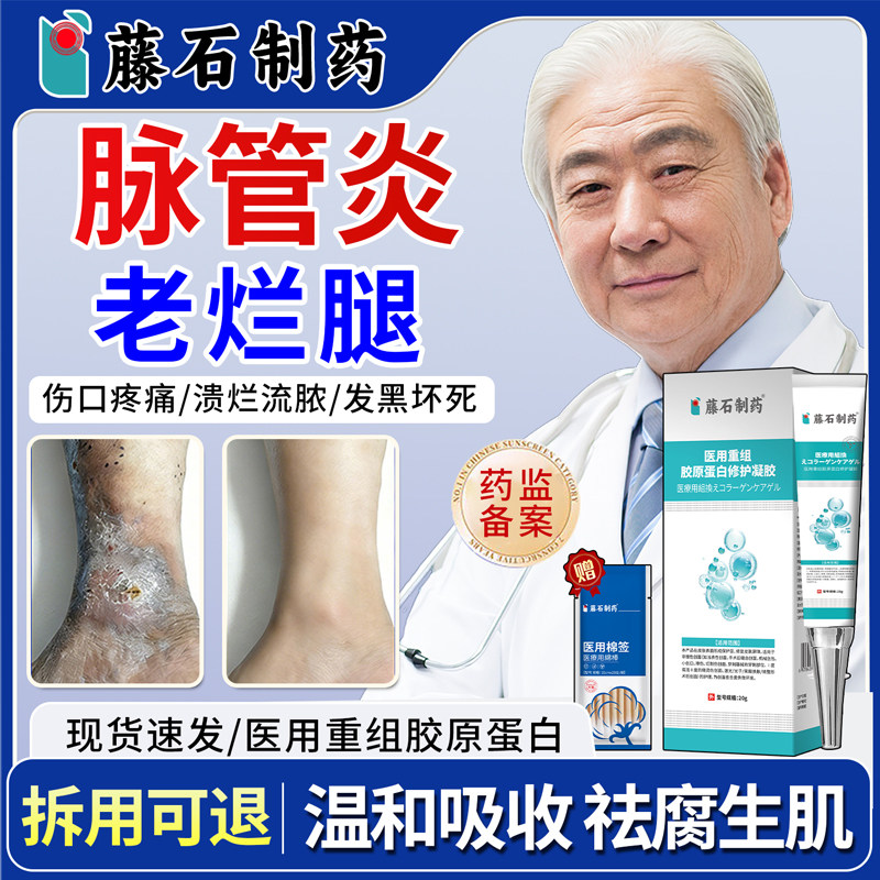 脉管炎老烂腿专特用膏贵愈合去腐生肌下肢静脉曲张药监备案XP