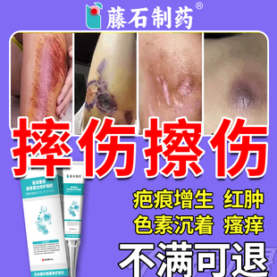 摔伤擦伤疤痕祛疤膏儿童擦伤伤口去疤痕黑印淡化黑色素沉淀修复XP