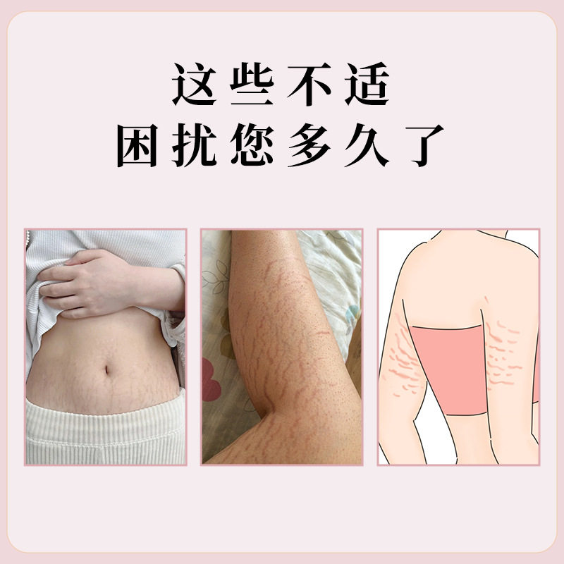 日本制药妊娠肥胖纹修复膏淡化产后剖腹产疤痕膏护理修护霜淡纹膏,家庭/个人清洁工具,洗漱包,淘宝优惠券,粉丝福利购,淘宝优惠卷