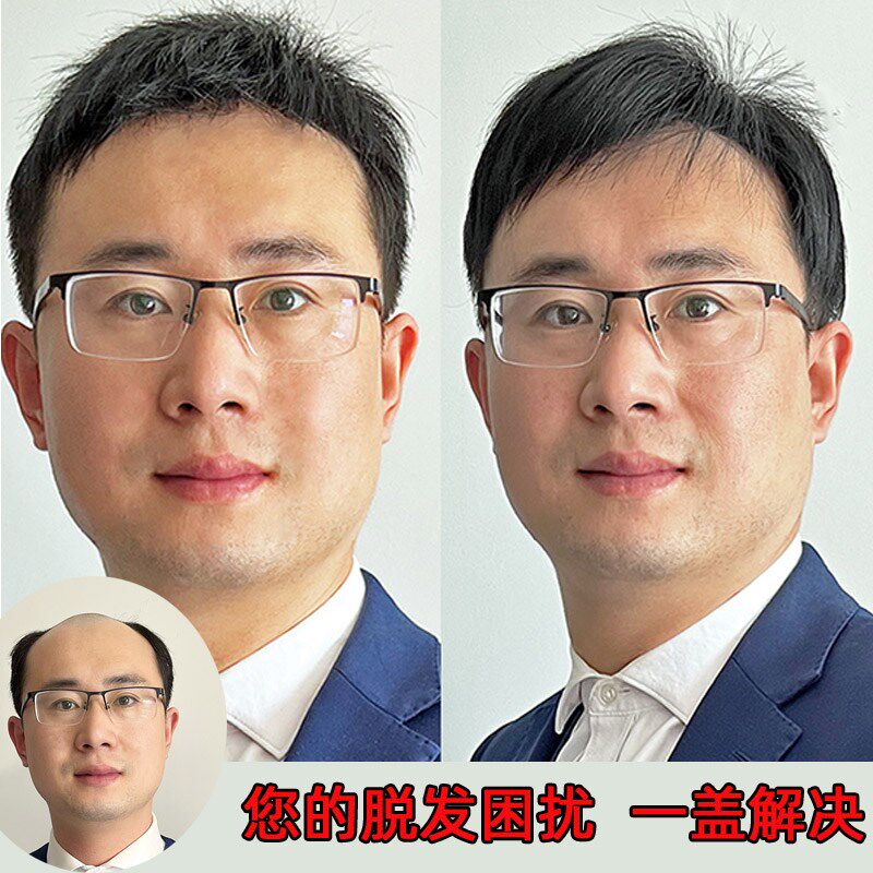 假发男士双递针头顶补发片自然发际线无痕隐形全真发秃顶补发块