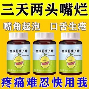 反复性口腔溃疡溃烂起泡口舌生疮消肿止痛补锌维生素金银花中药材