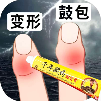 千年藏药手指疼痛骨节粗大变形手指关节疙瘩鼓包骨关节肿大止痛膏