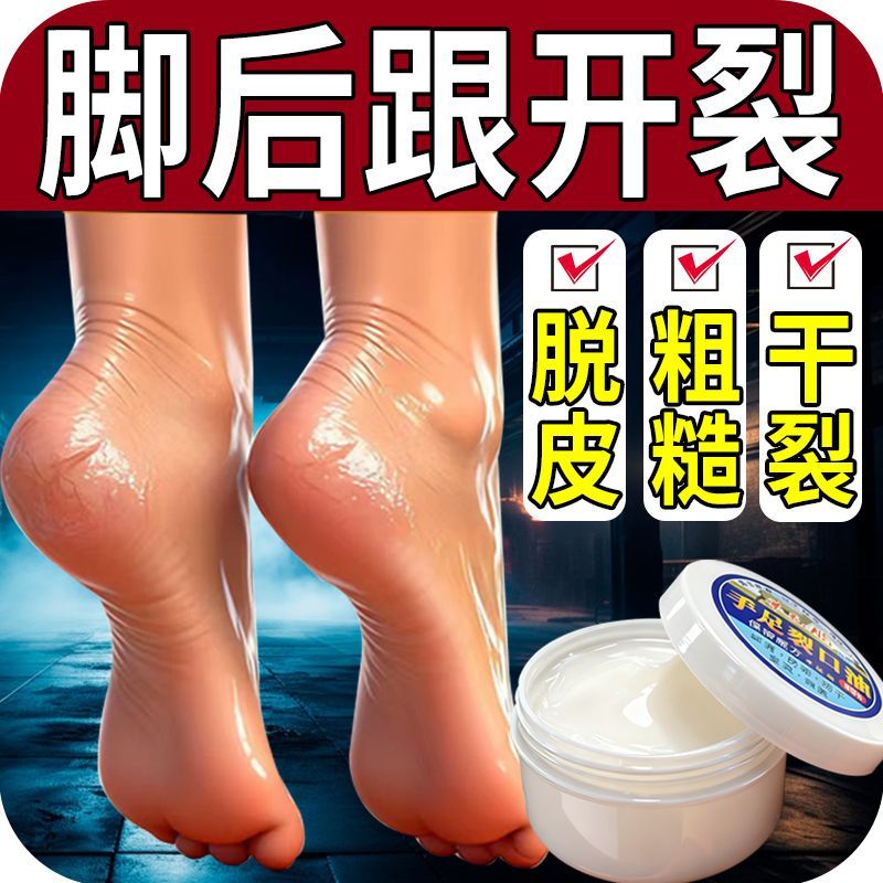 正品脚后跟开裂足裂手干裂皲裂膏防脚跟干燥皲护足修护霜