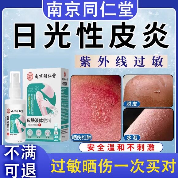 日光性皮炎紫外线过敏修覆霜专用膏药太阳晒伤皮肤止痒干燥瘙痒W