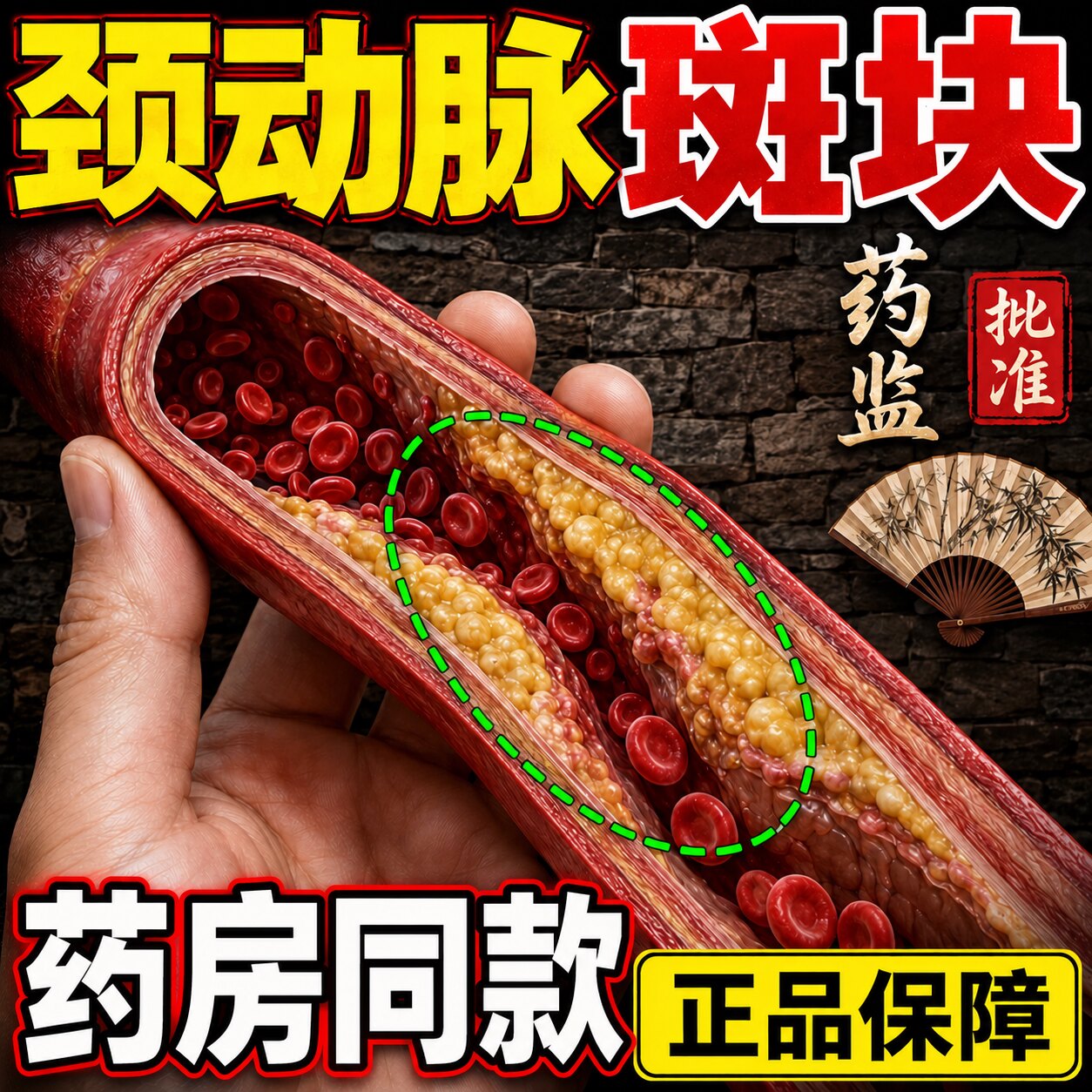 颈动脉斑块消除脑供血不足头晕药
