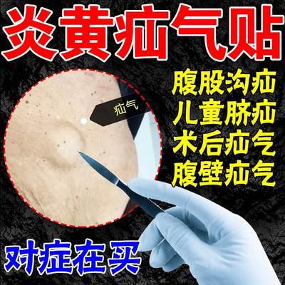 量子疝气贴腹股沟中老年专用婴儿凸肚脐疝非治疗带专用内裤内消丸