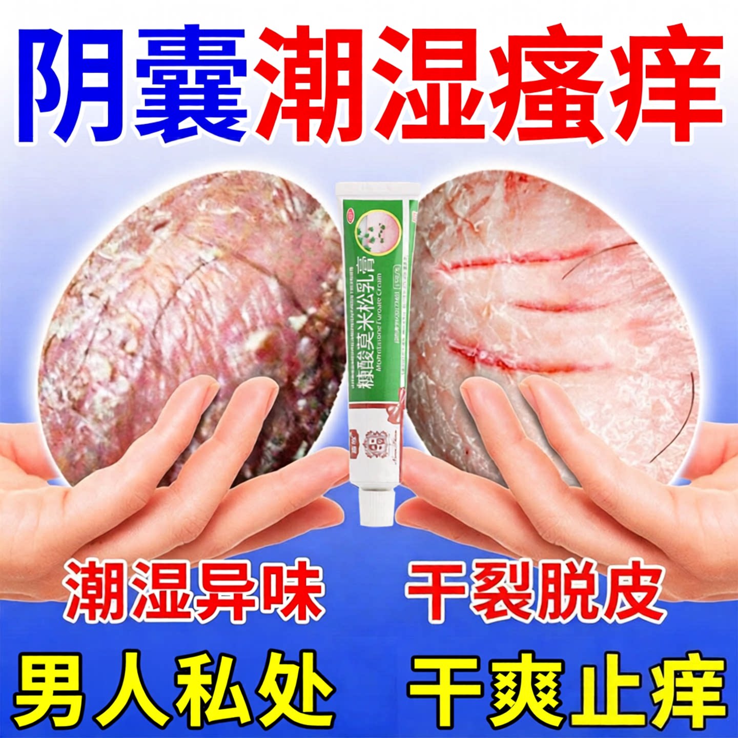 男性私处阴囊湿疹止痒药膏瘙痒糠酸莫米松软膏乳膏官方正品旗舰店