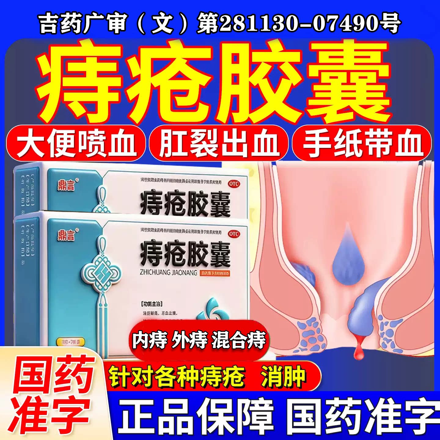 痔疮药痔疮胶囊止血特疼治大便出血专用效药内外痔混合痔肛门瘙痒