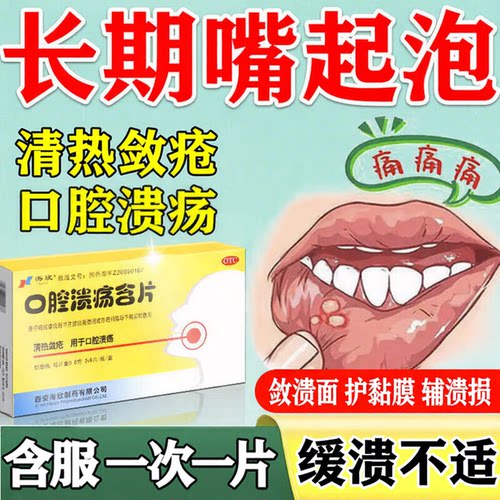 [海欣]口腔溃疡含片0.8g*12片/盒