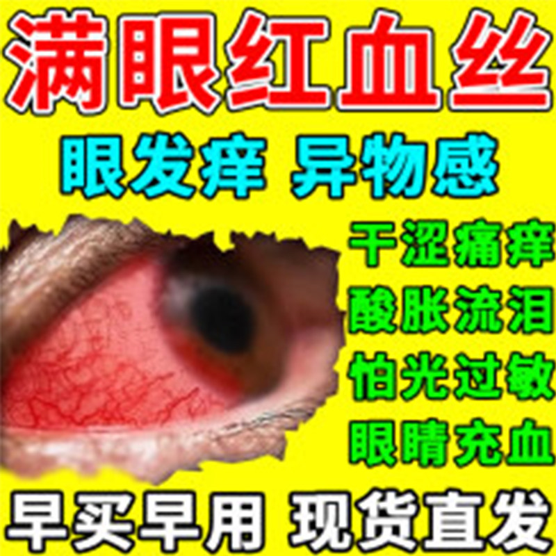 溴芬酸钠滴眼液进口治疗过敏性结膜炎巩膜炎前葡萄膜炎睑缘炎