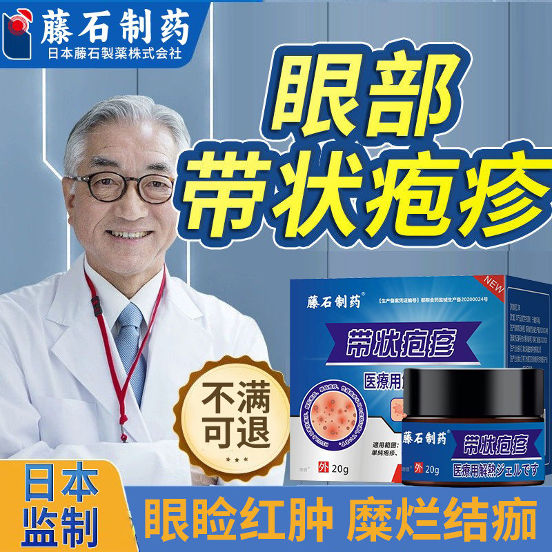 眼部带状疱疹蛇盘疮缠腰龙飞蛇胆疮神经痛后遗症ka