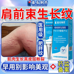 肩膀健身去肥胖纹生长纹修复膏霜青少年专外用的药监备案精油膏VP