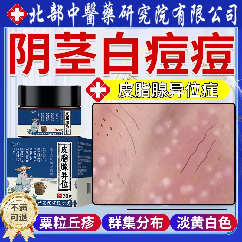 阴茎白痘痘包皮疙瘩小点脂肪粒皮脂腺异位症白点龟头阴囊瘙痒vp