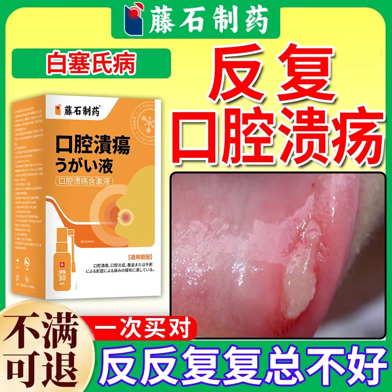 反复口腔溃疡白塞氏病复发性溃疡专用口角溃烂表皮破损VP