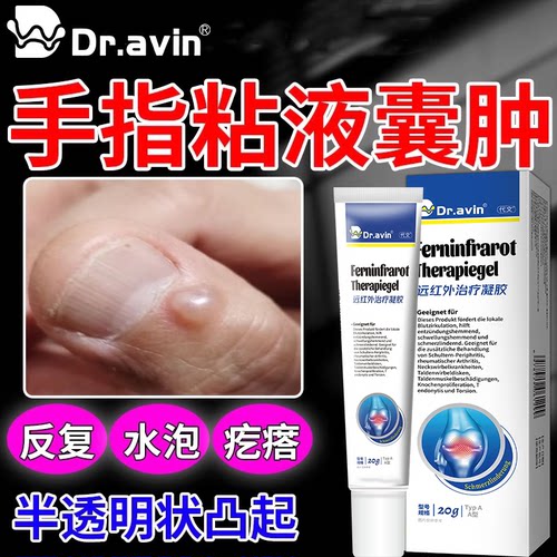 手指黏液粘液囊肿结节鼓包