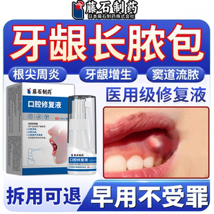 根尖周炎牙龈脓包肿痛消炎专外用喷剂牙根发炎增生息肉药监备案VP