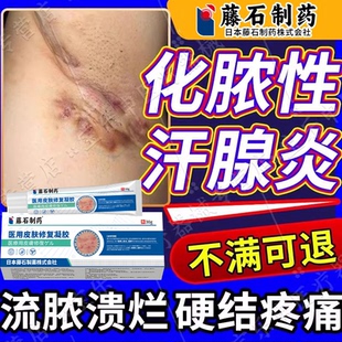 化脓性汗腺炎专腋窝下流脓溃烂硬结疼痛用腋窝下汗腺炎可搭药膏vp