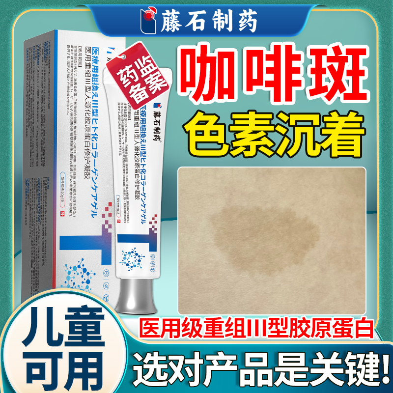 儿童牛奶咖啡斑胎记凝胶