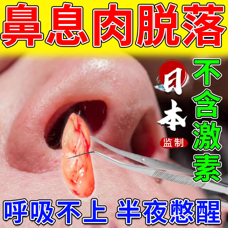 鼻息肉脱落专用治疗鼻窦炎修复鼻甲肥大鼻塞通鼻喷雾剂神器hb