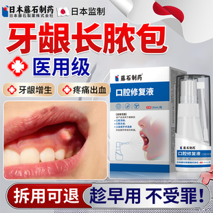 牙龈脓包肿痛消炎专用喷剂治牙根发炎牙周炎智齿冠鼓包药房同售OM