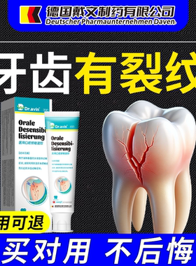 dr.vain德国戴文牙隐裂修复牙齿表面裂纹牙釉质损伤咬合疼痛K1