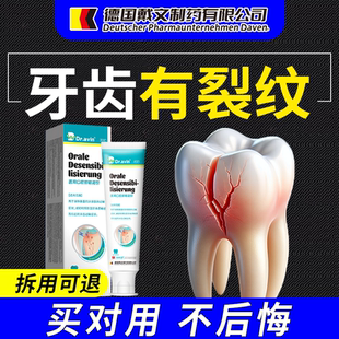 dr.vain德国戴文牙隐裂修复牙齿表面裂纹牙釉质损伤咬合疼痛K1
