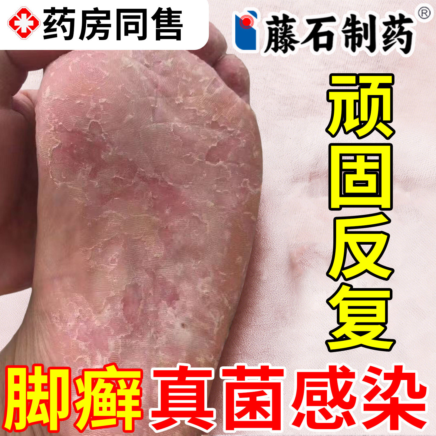 脚癣一次净官方旗舰店图片