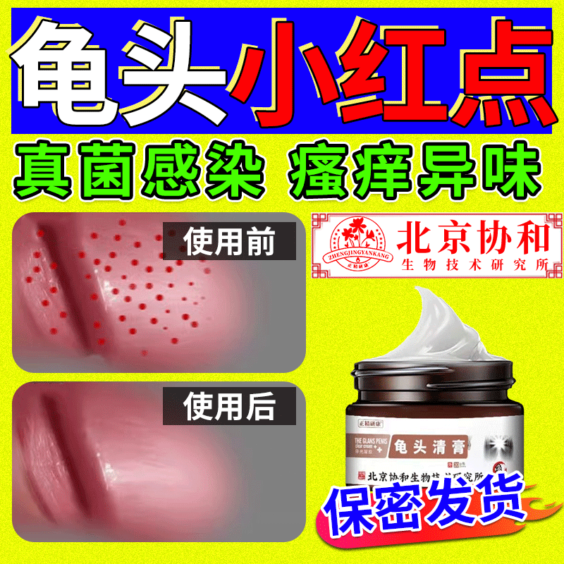 龟头上有小红点斑红肿裂口包皮炎男性真菌感染白垢豆腐渣瘙痒hvd