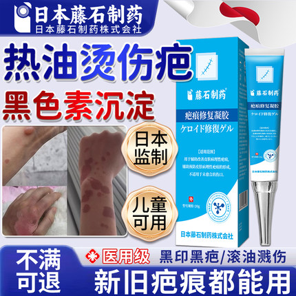 被热油烫伤溅伤疤痕修复凝胶去黑印黑色素沉淀除疤膏医用儿童OM