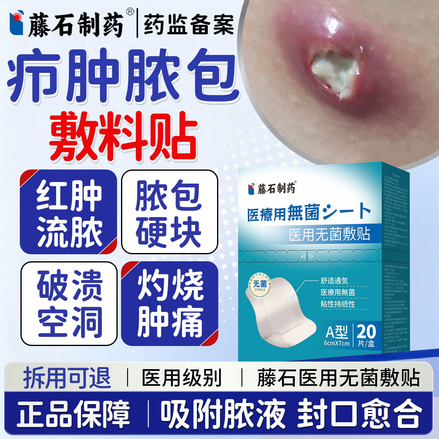 藤石制药疖肿敷贴火疖子敷料贴脓包硬块屁股长硬疙瘩吸脓神器OM图片