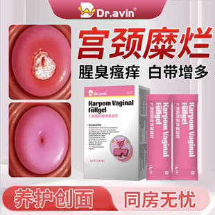 宫颈糜烂妇科凝胶肥大子宫内膜息肉二度三度消糜栓瘙痒抑菌BM