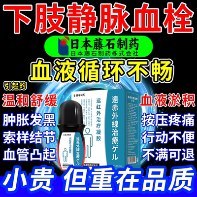 预防静脉瘤炎曲张肿痛冷敷凝胶
