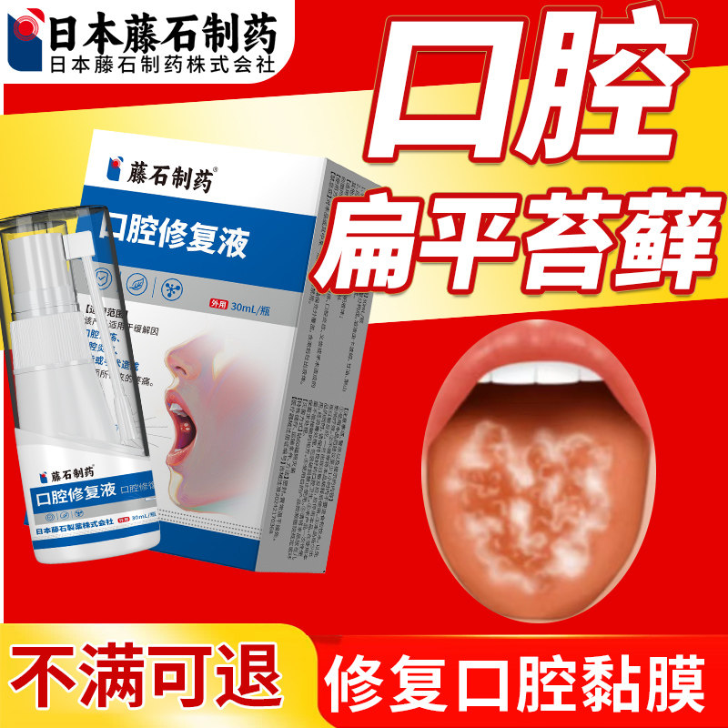 口腔扁平苔藓专用喷剂黏膜白斑舌头纤维化糜烂可搭牙膏药房同售OM