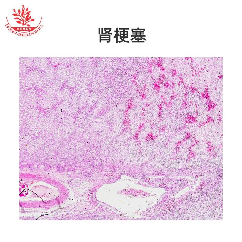 病理切片HE玻片细胞明显细胞核显示鲜亮细O胞膜染色病理清楚标本