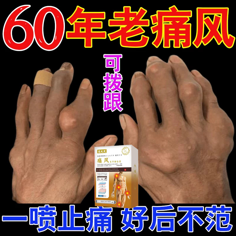 治腰疼腰痛专用药舒筋定痛胶囊痛风新...