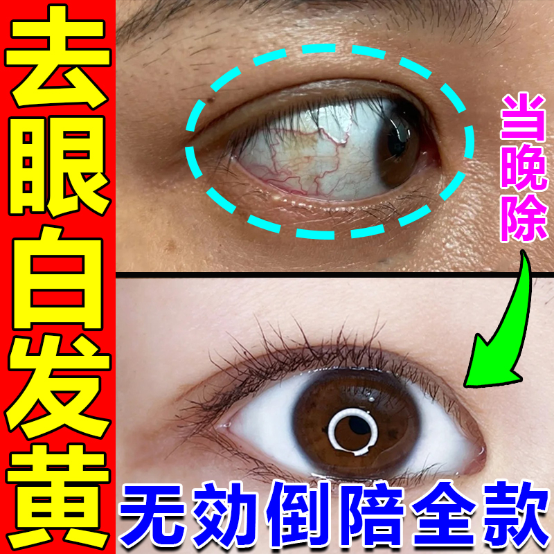 熊胆明目滴眼液眼睛模糊看不清人工熊胆明目干涩老花眼止痒眼药水