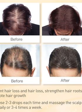 极速PURC Ginger Hair Growth Products Prevent HairU Loss Esse
