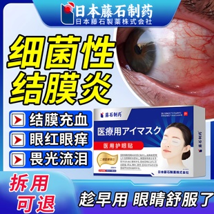医用病毒性结膜炎冷敷眼贴暴露性角膜炎眼睛痒可搭眼药水滴眼液ZR