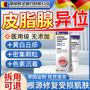 德国代文皮脂腺异位症嘴唇白点脂肪小增生颗粒干裂起皮药监备案JV