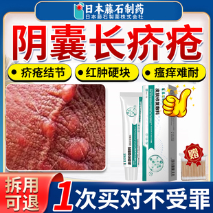 阴囊疥疮结节真菌感染男人私处潮湿瘙痒有异味抑菌去疥螨止痒膏ZR