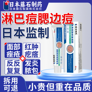 淋巴痘腮边痘专用下巴脸颊两边长痘引起痤疮结节硬块痘药监备案JV
