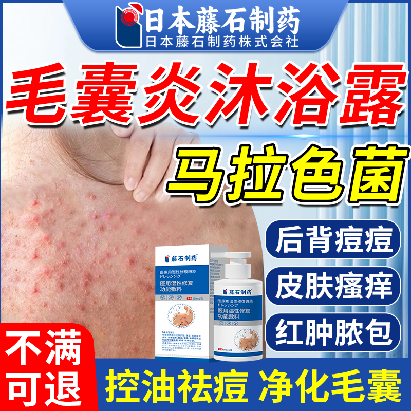 藤石制药背后长痘痘后背毛囊炎沐浴露马拉色菌前胸后背祛痘止痒AZ