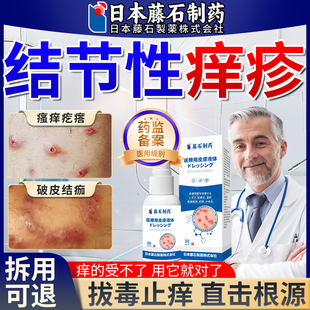 结节性痒疹皮肤湿疹特治顽固红硬疙瘩专用膏拔毒止痒药房同售ZR