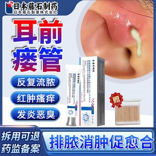 藤石制药先天性耳前瘘管发炎可搭药膏清理耳仓发炎流脓防水贴ZR
